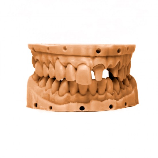 رزین مدلسازی ترمیم دندان رنگ زرد روشن برند ایسان Esun DM100 Dental Restoration Model Resin